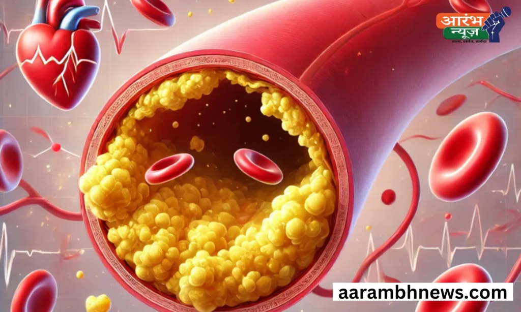 Cholesterol Se Bachaav