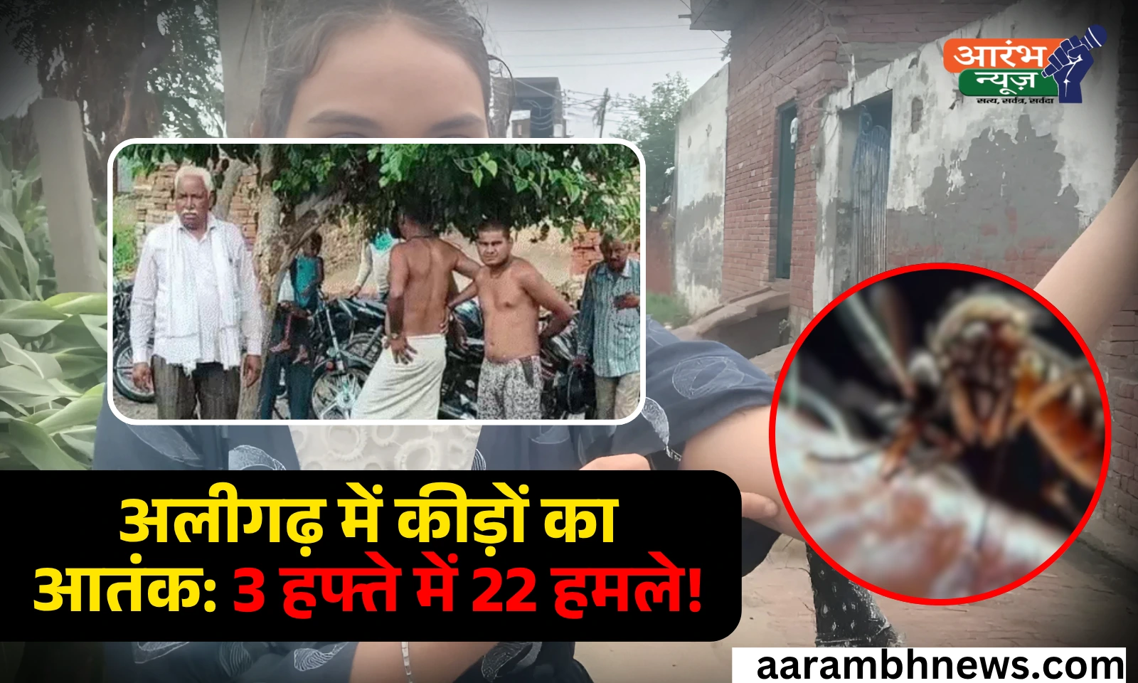 Mysterious Insect Bite का आतंक: अलीगढ़ गांव में 1 की मौत, 22 घायल 1 Mysterious Insect Bite का आतंक अलीगढ़ गांव में 1 की मौत, 22 घायल