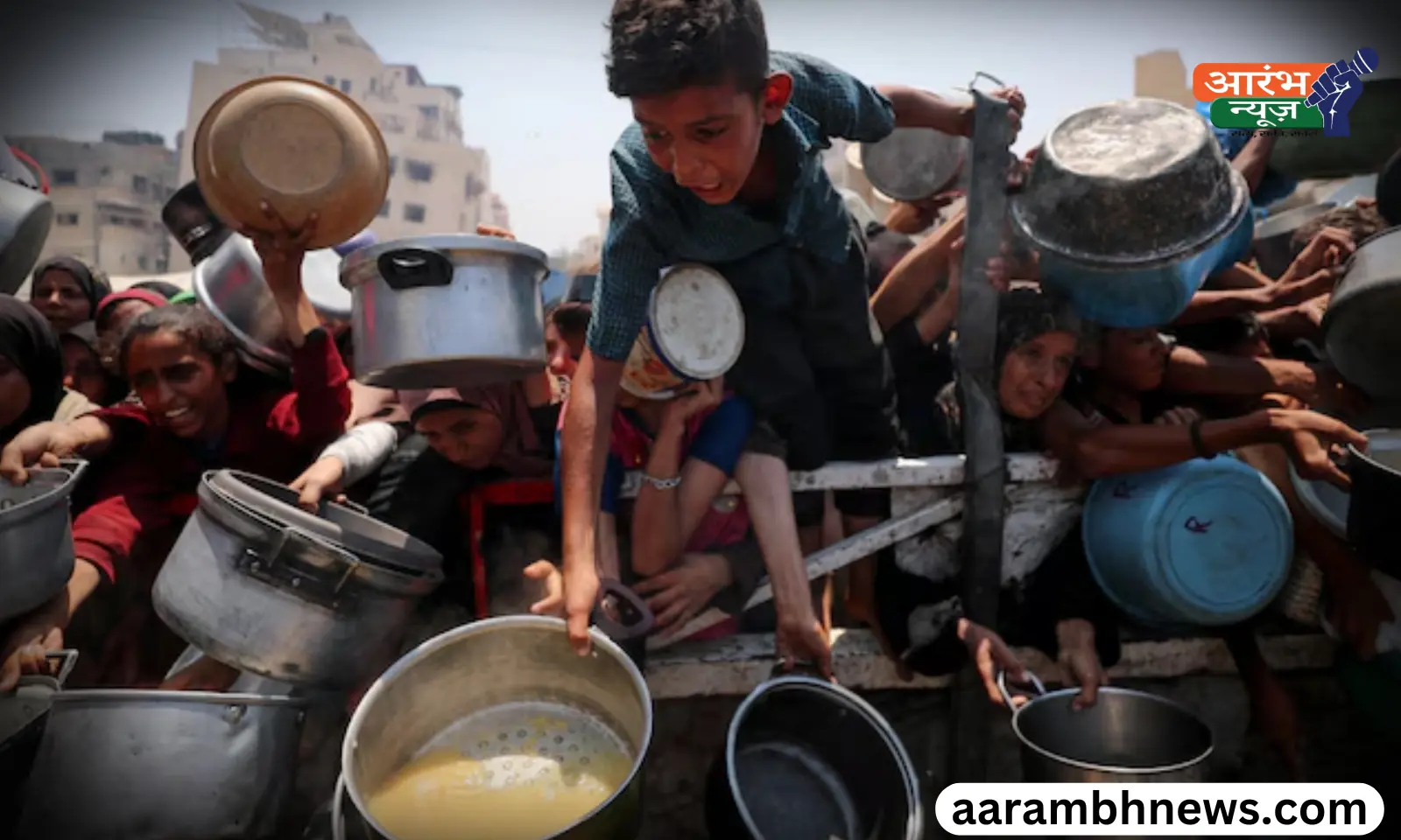 Gaza children malnutrition भूख से तड़पते मासूम, डॉक्टर बोले - ये बच्चे शायद कभी ठीक न हो पाएं
