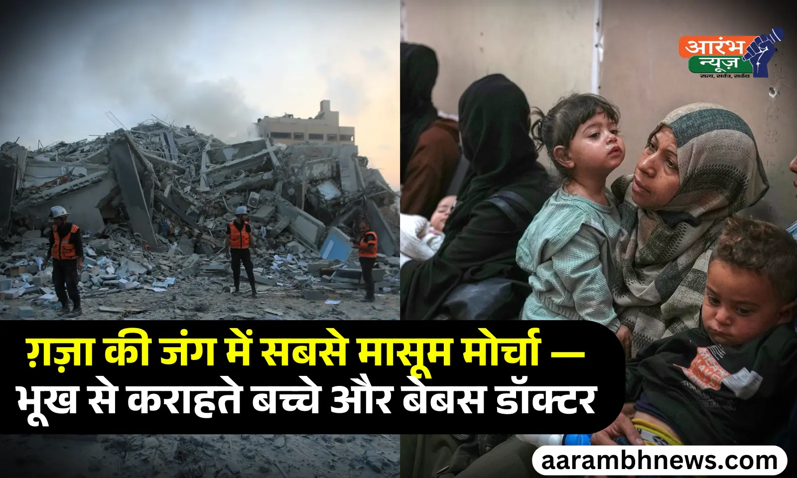 Gaza children malnutrition भूख से तड़पते मासूम, डॉक्टर बोले - ये बच्चे शायद कभी ठीक न हो पाएं