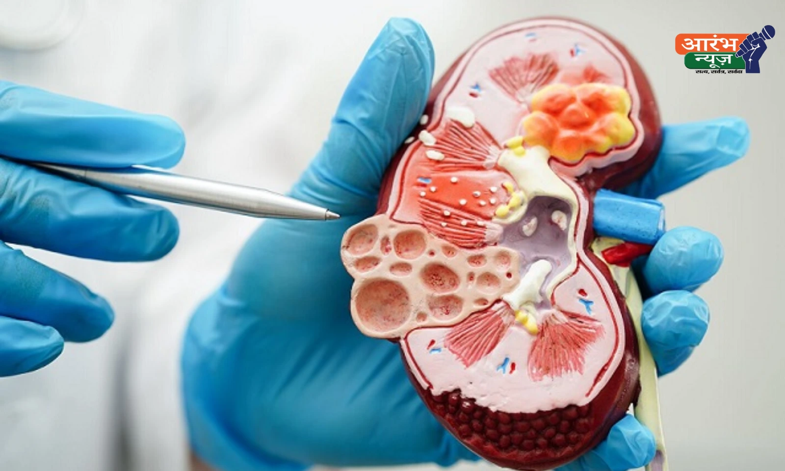 Chronic Kidney Disease