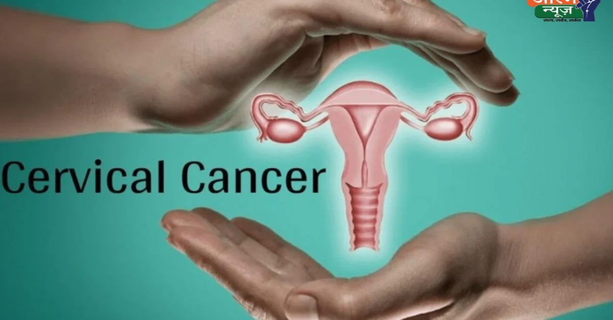Cervical Cancer