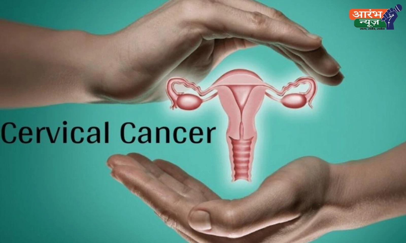 Cervical Cancer