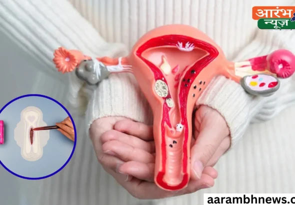 Uterine Fibroids