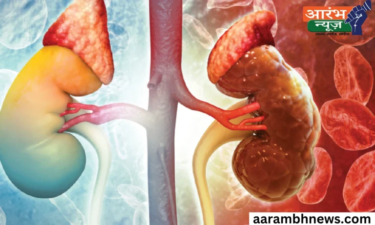 Creatine Supplement Danger: बॉडी बनाने के चक्कर में युवक की दोनों किडनी डैमेज, जानिए कितना खतरनाक है यह ट्रेंड 1 Creatine Supplement Danger