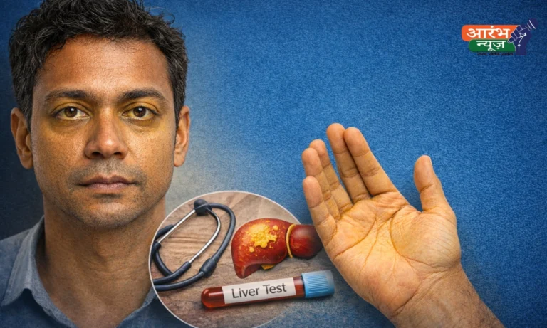 पलवल में Jaundice-Hepatitis (पीलिया-हेपेटाइटिस) से 12 मौतें: ये 8 लक्षण दिखें तो तुरंत जांच कराएं, बचाव के लिए अपनाएं 10 उपाय 12 Jaundice-Hepatitis