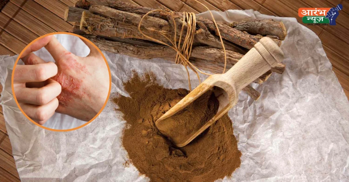 Natural remedy for eczema