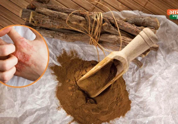 Natural remedy for eczema