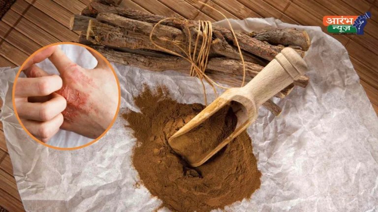 Natural remedy for eczema