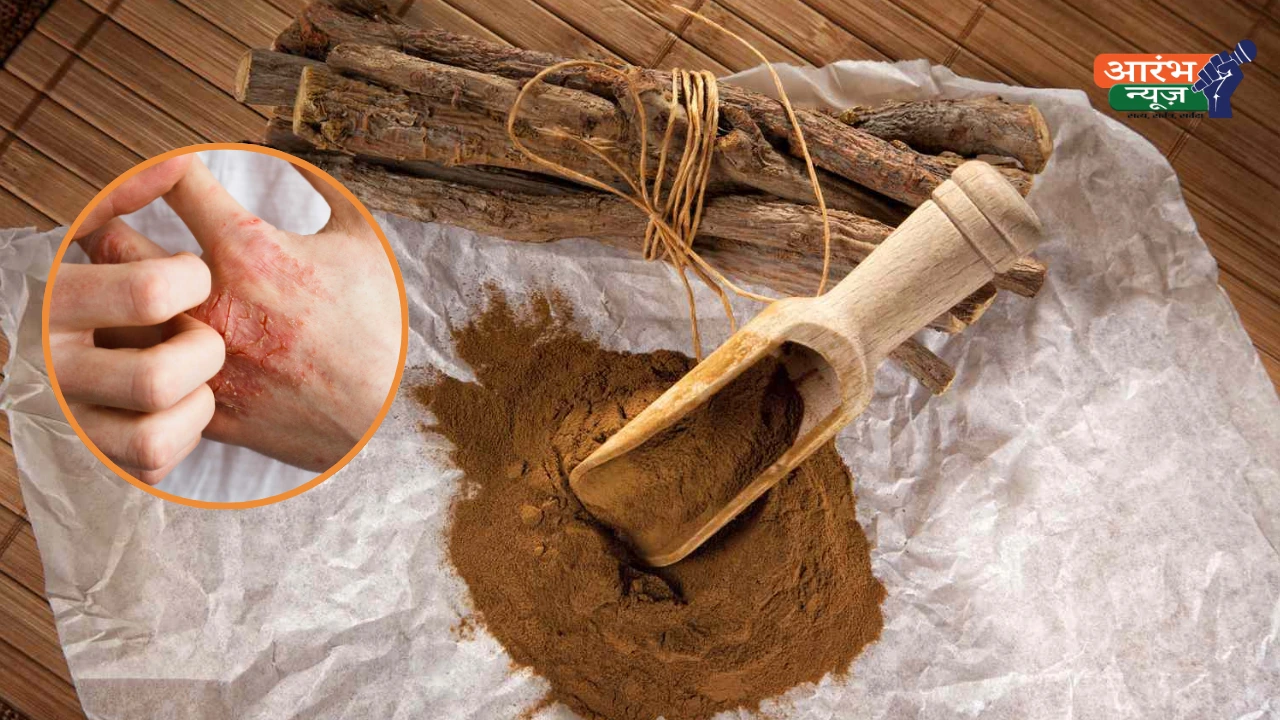 Natural remedy for eczema